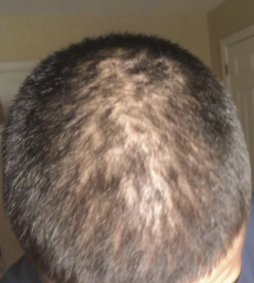 Day 1